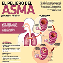 Cambio Climático Aumenta Casos De Asma En El Mundo, Alertan Expertos